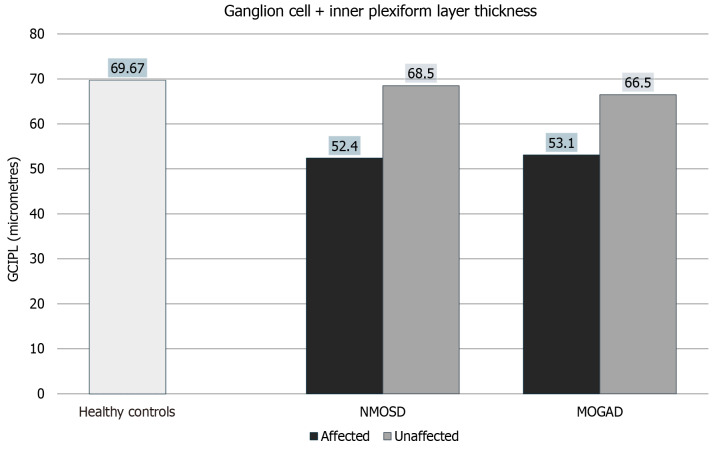 Macular microvascular and structural changes on optical coherence tomography angiography in atypical optic neuritis.