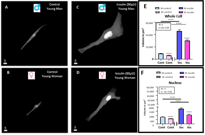 In Vitro Chronic Hyperinsulinemia Induces Remodelling of Vascular Smooth Muscle Cells from Young Men and Women in a Sex Hormone Independent Manner.