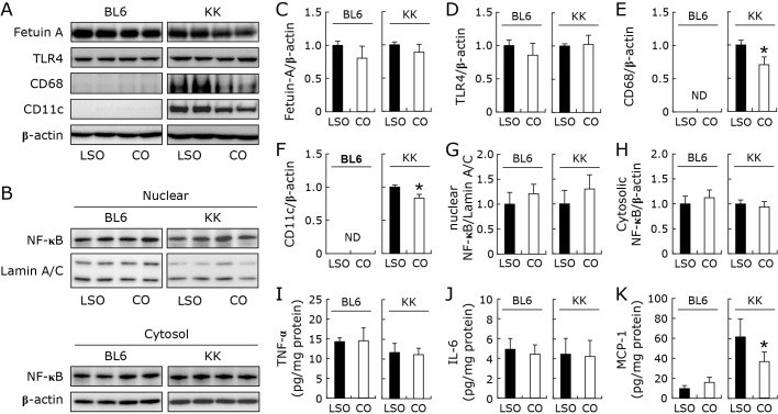 Dietary coconut oil lowered circulating fetuin-A levels and hepatic expression of fetuin-A in KK/TaJcl mice.