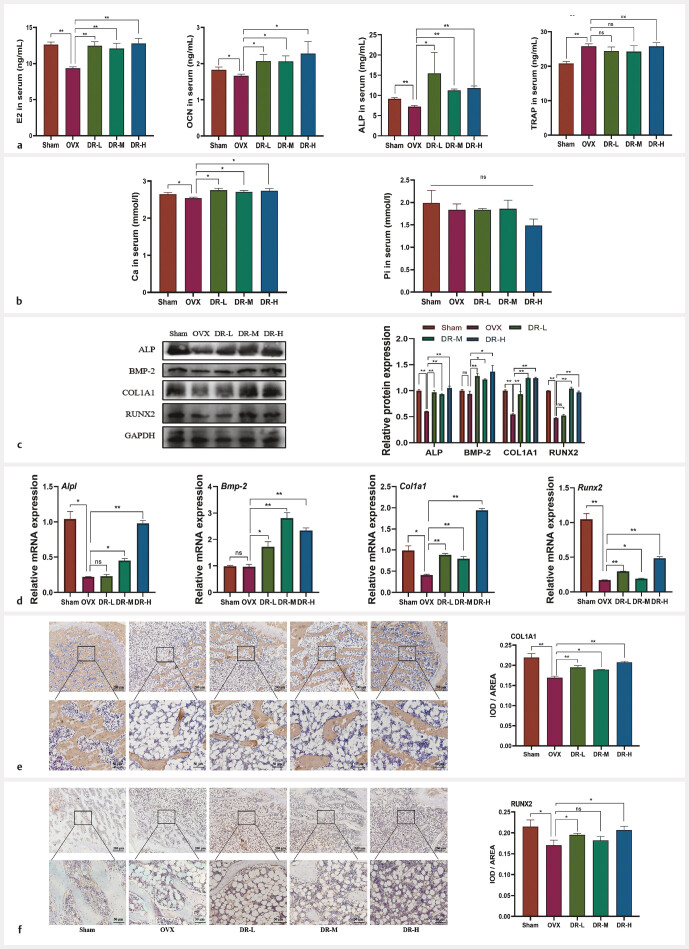 Extracts of Drynariae Rhizoma Promote Bone Formation in OVX Rats through Modulating the Gut Microbiota.
