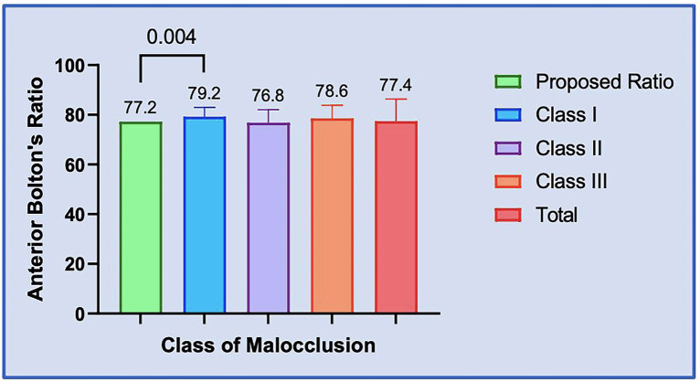 Bolton's ratio variations in Angle's Class I, Class II and Class III malocclusions: An observational study.