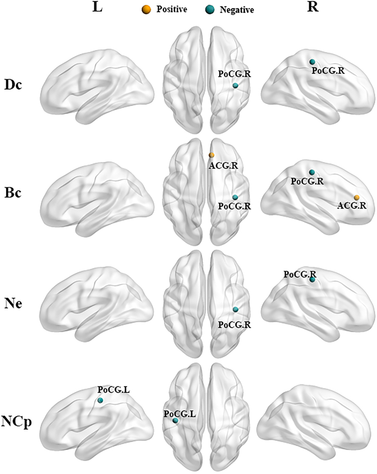 Brain network alterations in mobile phone use problem severity: A multimodal neuroimaging analysis.