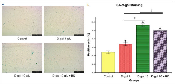 Effects of D-galactose Induction on Aging Characteristics of the Human Dental Pulp Cell Culture Model: An In Vitro Study.
