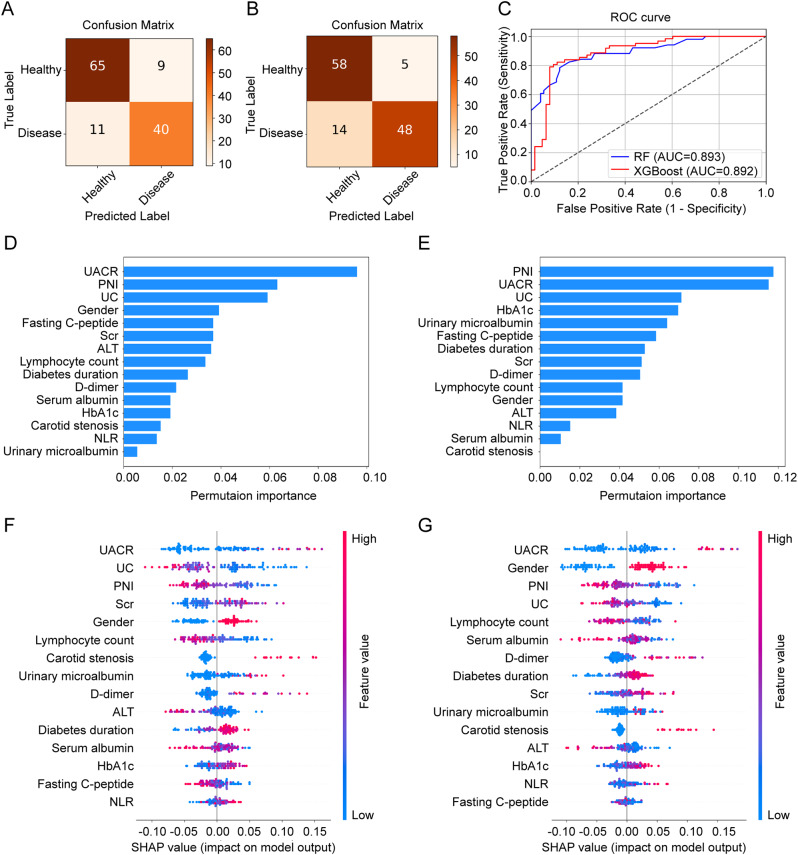 Prognostic nutritional index and diabetic peripheral neuropathy in type 2 diabetes: a machine learning approach.