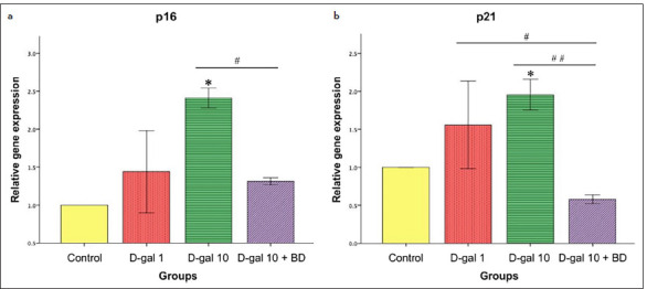 Effects of D-galactose Induction on Aging Characteristics of the Human Dental Pulp Cell Culture Model: An In Vitro Study.