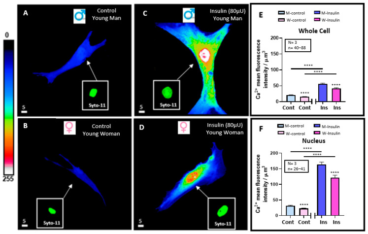 In Vitro Chronic Hyperinsulinemia Induces Remodelling of Vascular Smooth Muscle Cells from Young Men and Women in a Sex Hormone Independent Manner.