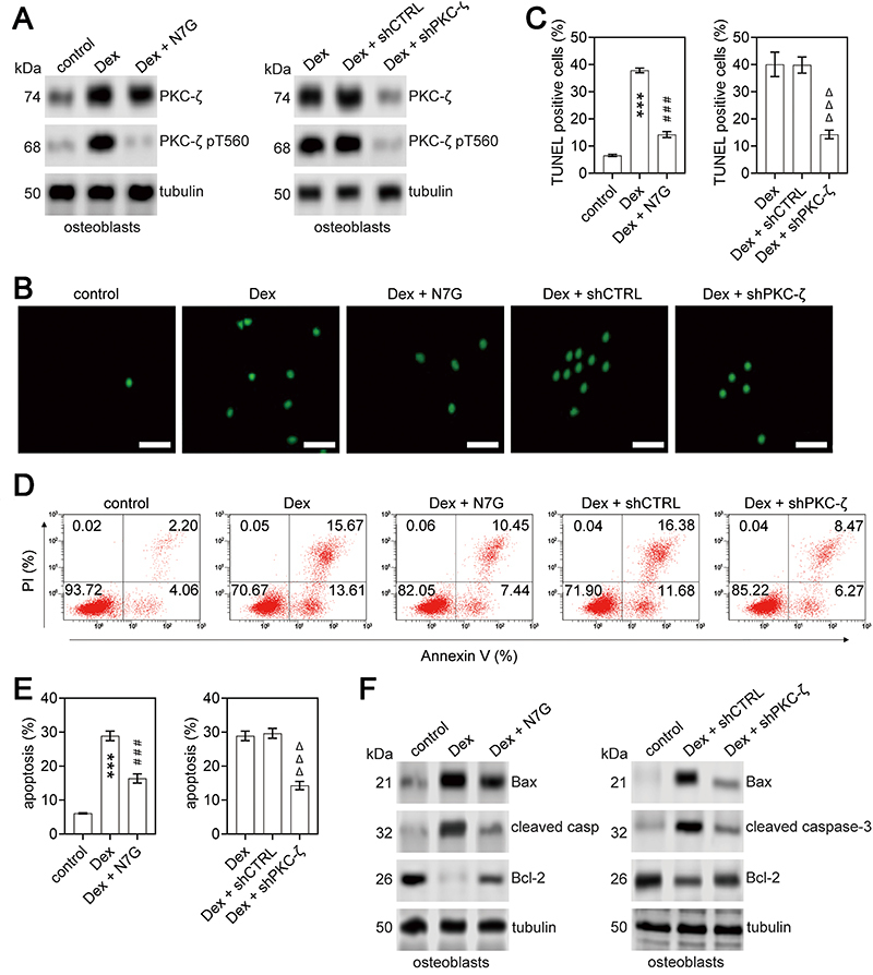 The role of the PKCζ/JNK signaling pathway in regulating the development of femoral head necrosis.