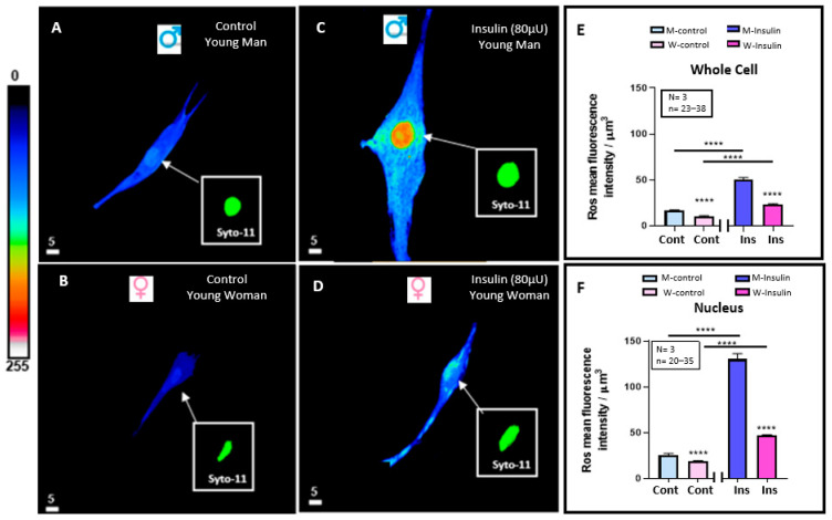 In Vitro Chronic Hyperinsulinemia Induces Remodelling of Vascular Smooth Muscle Cells from Young Men and Women in a Sex Hormone Independent Manner.