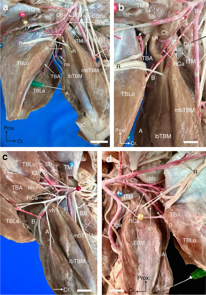 Five-headed triceps brachii muscle, with an unusual communication between the musculocutaneous and median nerves in a cross-breed dog cadaver: a case report.