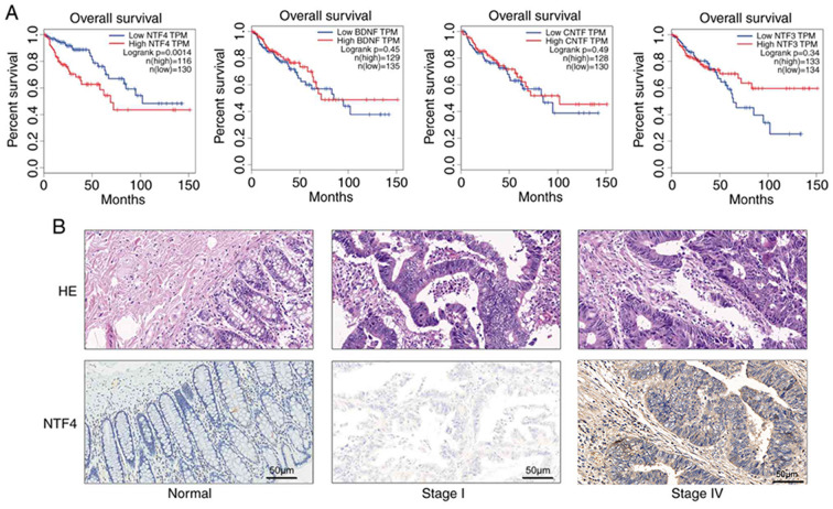 [Corrigendum] Upregulated NTF4 in colorectal cancer promotes tumor development via regulating autophagy.