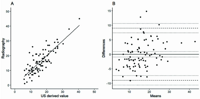 Ultrasound <i>vs.</i> x-ray: a new way for clinicians to track scoliosis progression?