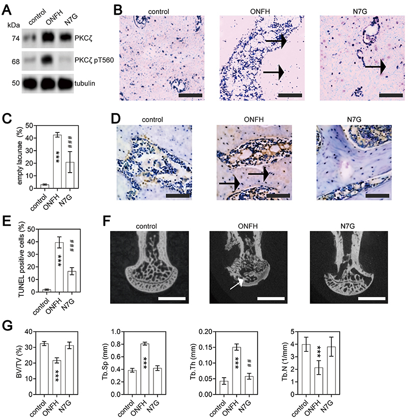 The role of the PKCζ/JNK signaling pathway in regulating the development of femoral head necrosis.