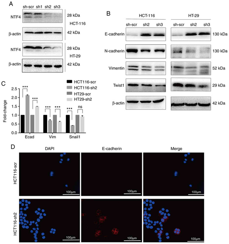 [Corrigendum] Upregulated NTF4 in colorectal cancer promotes tumor development via regulating autophagy.