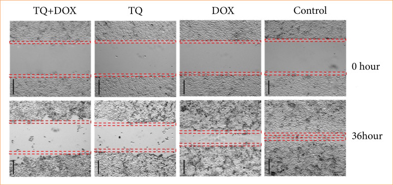 Investigation of the effect of thymoquinone and doxorubicin on the EGFR/FOXP3 signaling pathway in OVCAR3 human ovarian adenocarcinoma cells.