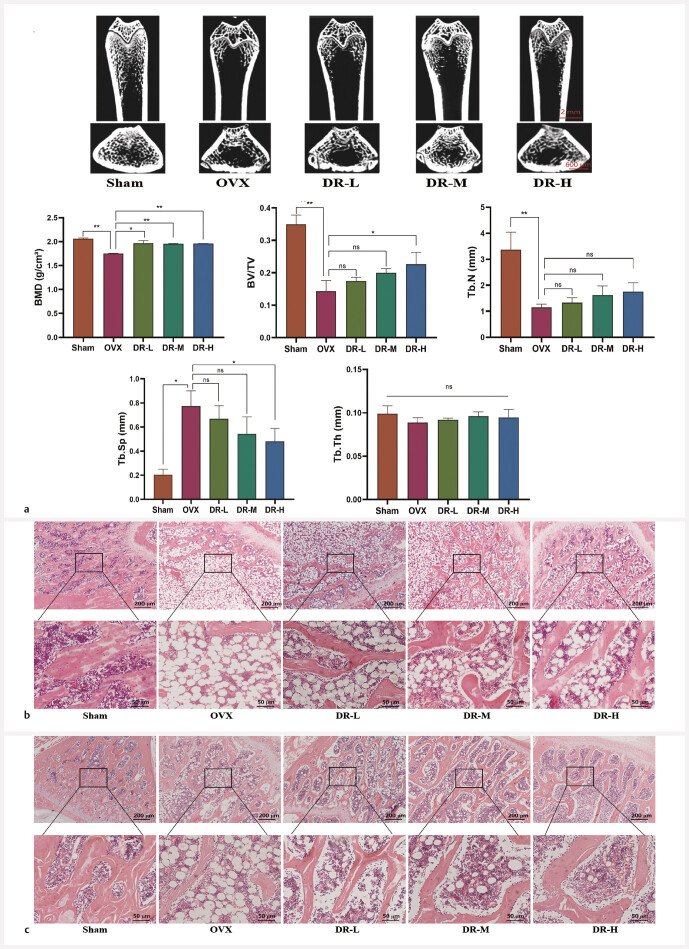 Extracts of Drynariae Rhizoma Promote Bone Formation in OVX Rats through Modulating the Gut Microbiota.