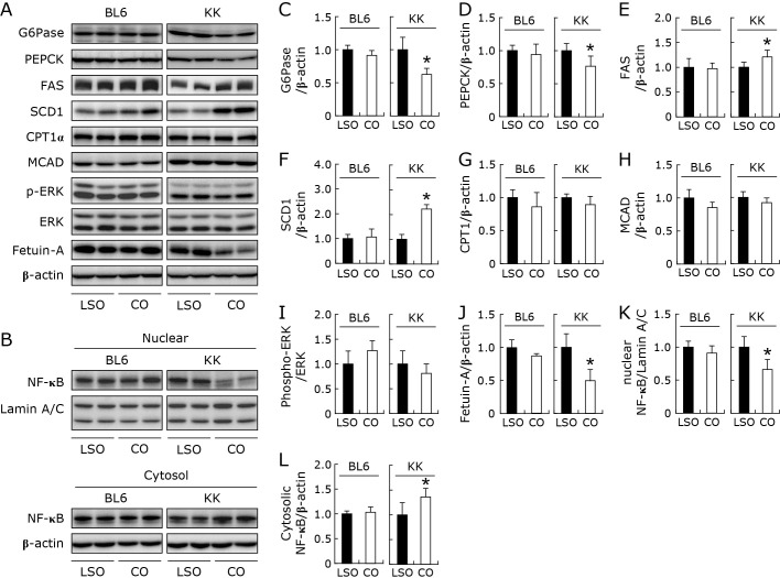 Dietary coconut oil lowered circulating fetuin-A levels and hepatic expression of fetuin-A in KK/TaJcl mice.