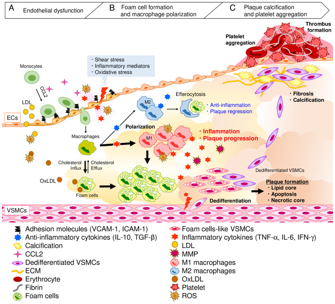 Anti?atherosclerotic effect of aged garlic extract: Mode of action and therapeutic benefits (Review).