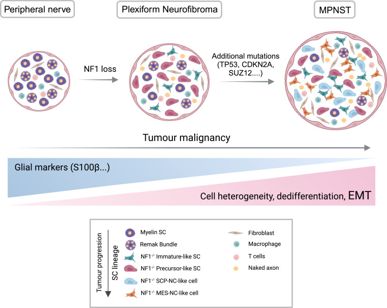 Schwann cells in regeneration and cancer: an epithelial-mesenchymal transition perspective.