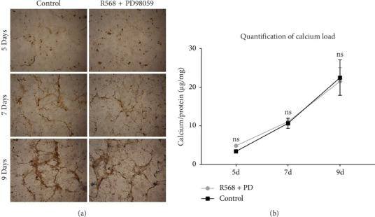 The Calcimimetic R568 Reduces Vascular Smooth Muscle Cell Calcification in Vitro Via ERK 1/2 Phosphorylation.