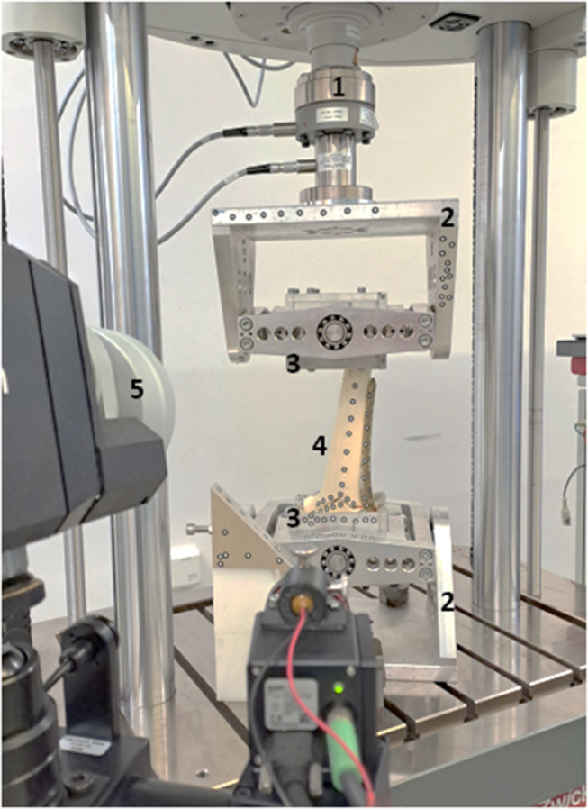 Impact of fracture morphology on the biomechanical stability of osteosynthetic fixation.