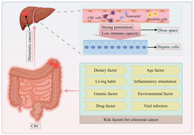 Pathogenetic development, diagnosis and clinical therapeutic approaches for liver metastasis from colorectal cancer (Review).