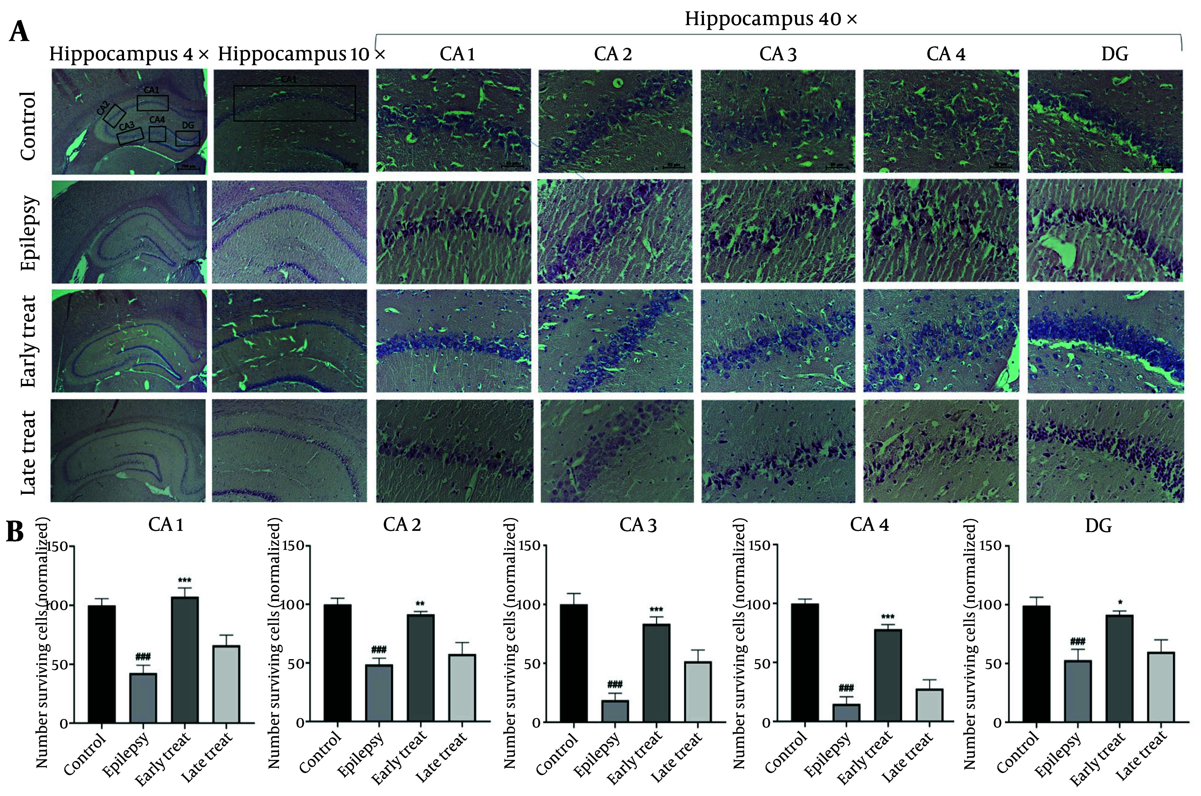 Neuroprotective Effects of Early TLR4 Blockade with Compound C34 in Temporal Lobe Epilepsy: Alleviation of Neuroinflammation and Apoptosis.