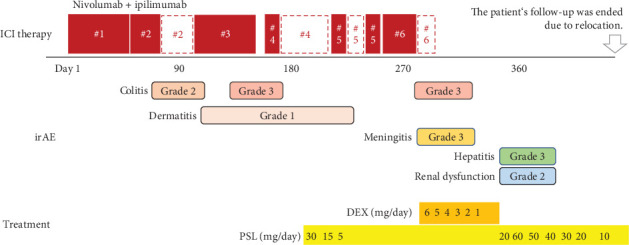 Remarkable Antitumor Effects and Serious Multiple Immune-Related Adverse Events in Malignant Pleural Mesothelioma: Two Case Reports.