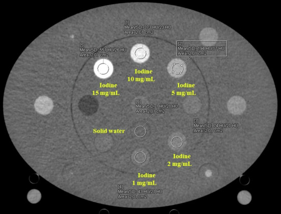 Photon-counting versus energy-integrating CT of abdomen-pelvis: a phantom study on the potential for reducing iodine contrast media.