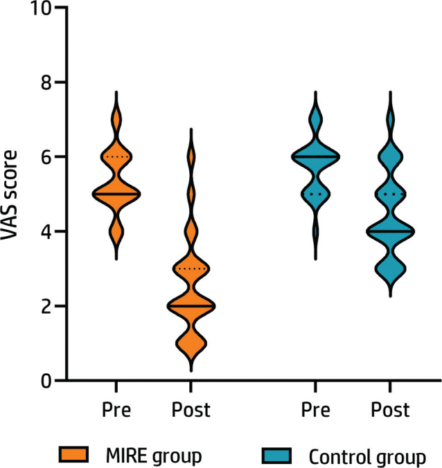 Would integrating monochromatic infrared energy into the physical rehabilitation of adolescents with patellofemoral pain syndrome have any advantageous effects? A randomized controlled trial.