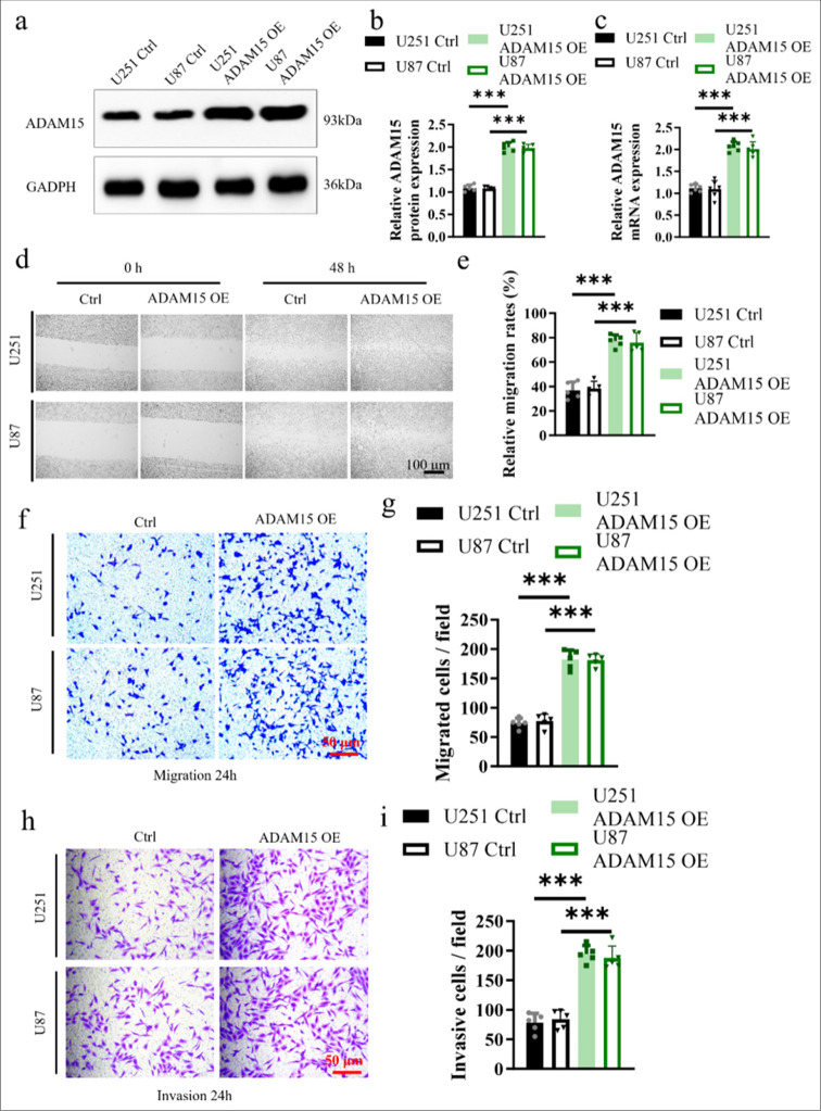 A disintegrin-like and metalloproteinase 15 facilitates glioblastoma proliferation and metastasis through activation of the protease-activated receptor 1.