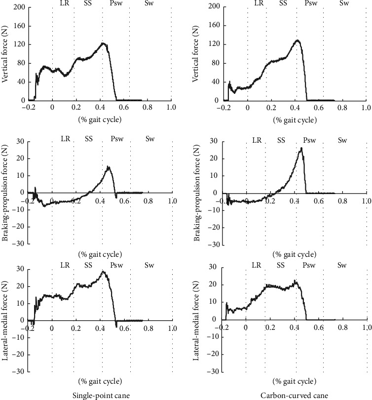 Effect of the Carbon-Curved Cane Use on Gait in Chronic Stroke-Induced Hemiplegia: A Prospective Single-Case Study.