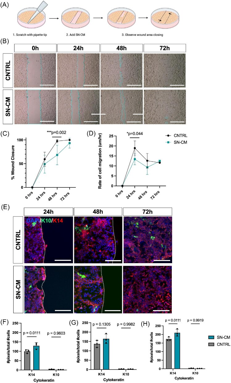 Sensory nerve-secreted factors regulate basal keratinocyte function <i>in vitro</i>.