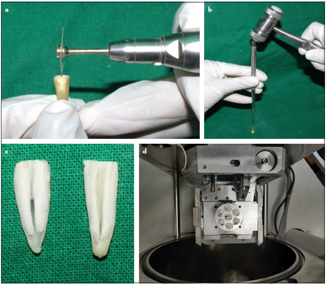 Comparative Evaluation of the Effect of EDTA, Chitosan, Etidronic Acid, and Silver Citrate on the Mineral Content of Root Canal Dentin Using Energy Dispersive X-ray Spectroscopy: An In-Vitro Study.