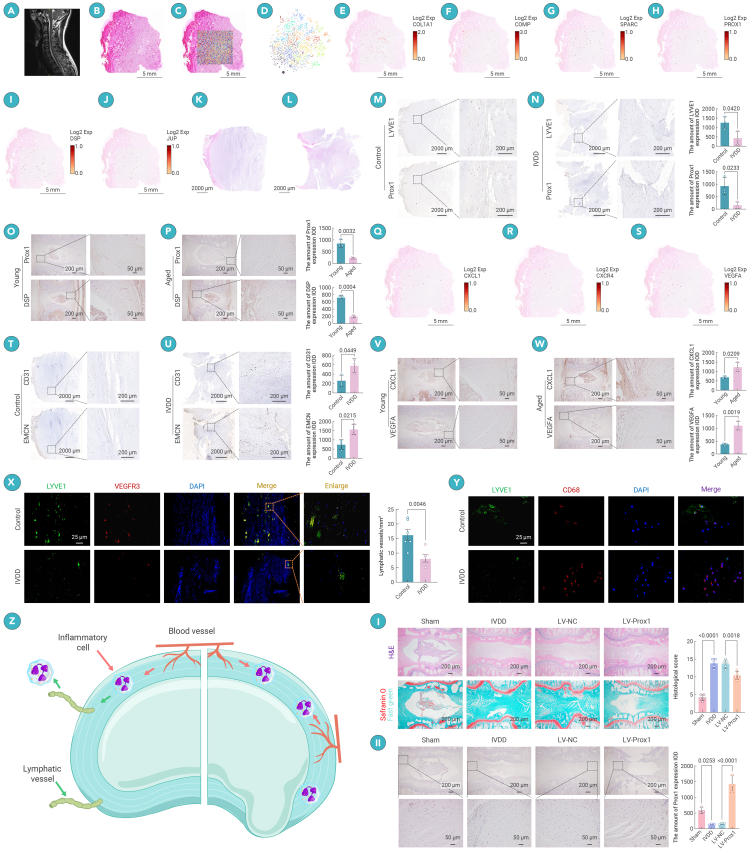 Revealing the presence of lymphatic vessels within intervertebral discs: Novel insights into disc degeneration.