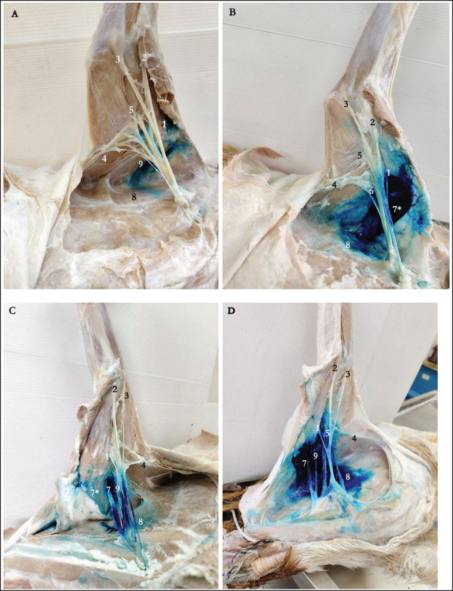 Comparison of two blind brachial plexus blocks in goat cadavers.
