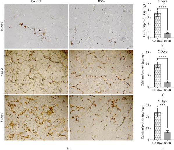 The Calcimimetic R568 Reduces Vascular Smooth Muscle Cell Calcification in Vitro Via ERK 1/2 Phosphorylation.