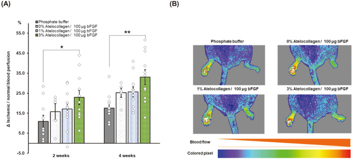 Angiogenesis Using Recombinant Basic Fibroblast Growth Factor With Atelocollagen in Normal and Hind Limb Ischemia Models.