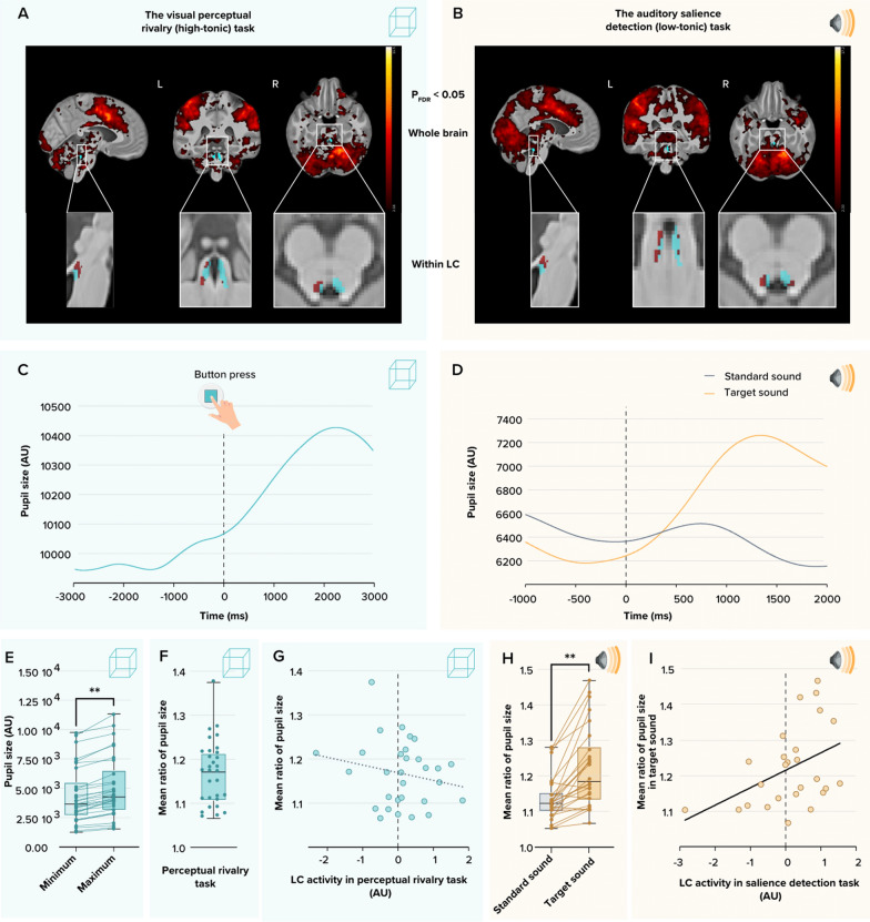 REM sleep quality is associated with balanced tonic activity of the locus coeruleus during wakefulness.