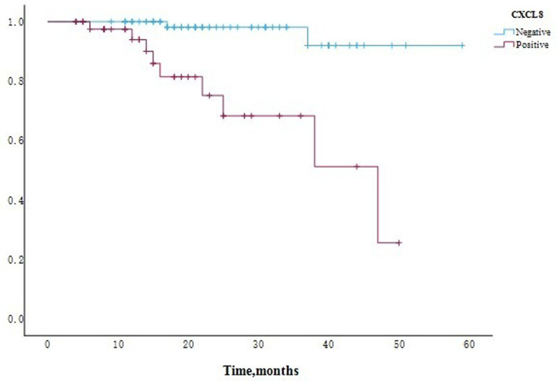 High CXCL8 expression predicting poor prognosis in triple-negative breast cancer.