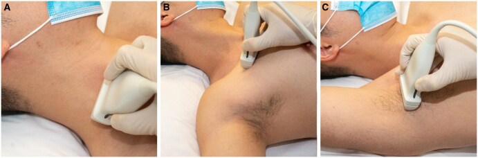Don't be perplexed by the plexus! A practical approach to brachial plexus ultrasound.