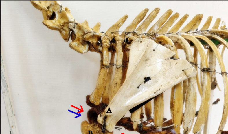 Comparison of two blind brachial plexus blocks in goat cadavers.