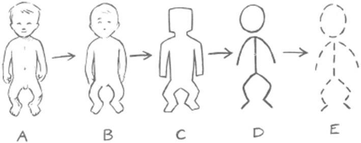 Recommendations for Improving Surveillance of Congenital Anomalies in Europe Using Healthcare Databases.
