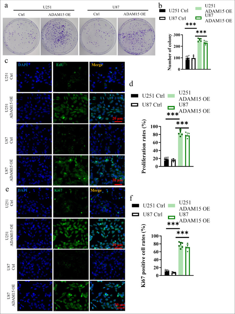A disintegrin-like and metalloproteinase 15 facilitates glioblastoma proliferation and metastasis through activation of the protease-activated receptor 1.