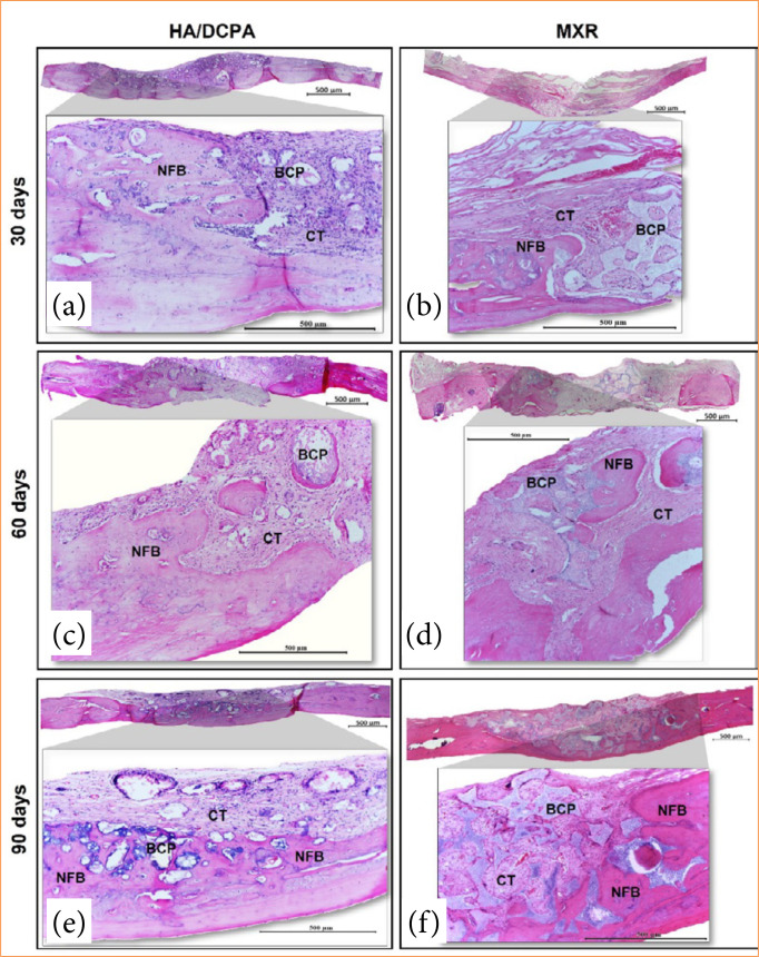 A new eggshell-derived calcium phosphate bioceramic for tissue engineering: cytotoxicity and histomorphometric study.