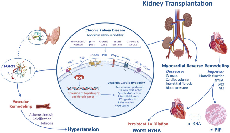 Role of kidney transplantation in long-term cardiac reverse remodeling and interconnecting mechanisms in type 4 cardiorenal syndrome.