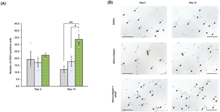 Angiogenesis Using Recombinant Basic Fibroblast Growth Factor With Atelocollagen in Normal and Hind Limb Ischemia Models.