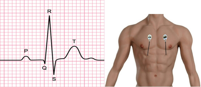 Multimodal machine learning for deception detection using behavioral and physiological data.