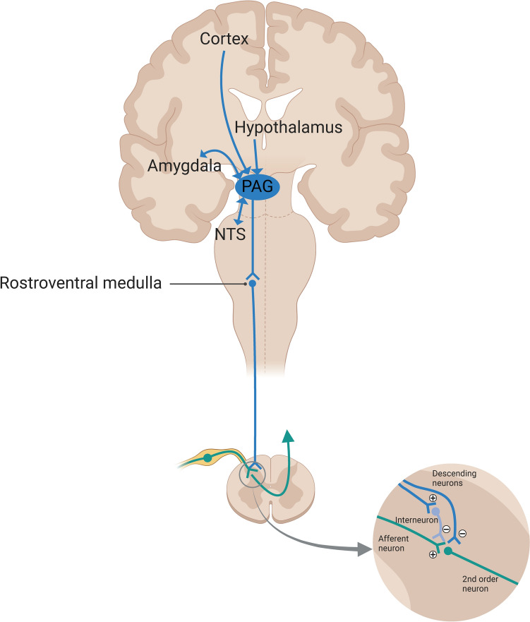 Visceral Pain in Preterm Infants with Necrotizing Enterocolitis: Underlying Mechanisms and Implications for Treatment.