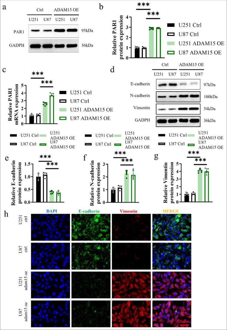 A disintegrin-like and metalloproteinase 15 facilitates glioblastoma proliferation and metastasis through activation of the protease-activated receptor 1.