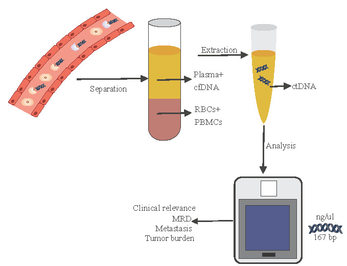 Circulating tumour DNA as a promising biomarker for breast cancer diagnosis & treatment monitoring.